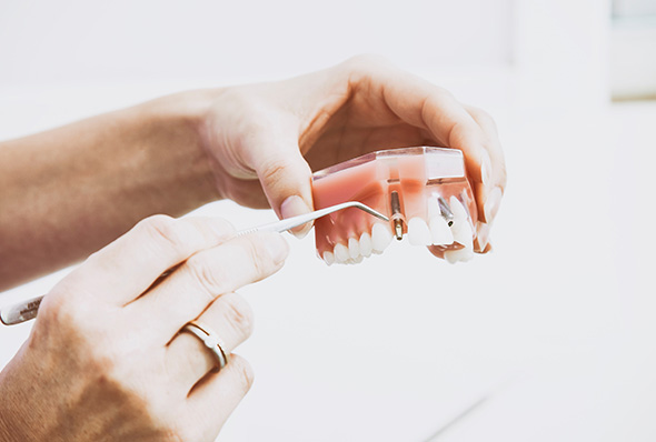 fake-teeth